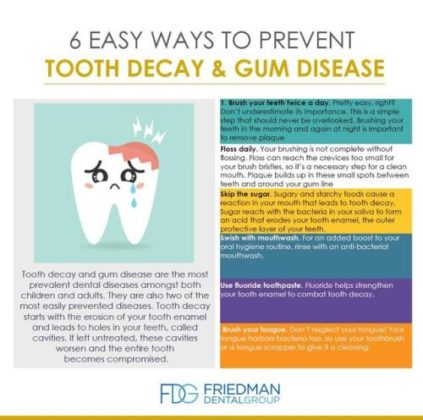 Things you can do to Prevent Tooth Decay via @... - InfographicNow.com ...