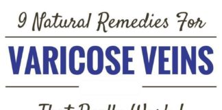 Health infographic : 9 Natural Remedies for Varicose Veins. Vitamin C, Flavonoid-rich foods, Horse ch…