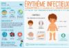 Health infographic : Infographie sur l'érythème infectieux