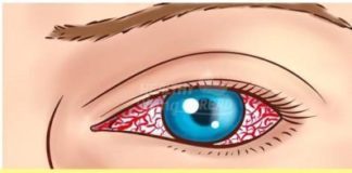 Healthcare infographic : 10 Signs You Have Been Exposed To Toxic Mold!