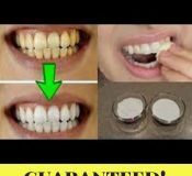 Healthcare infographic : Guaranteed Remedy To Whiten Your Teeth In Just 2 Minutes