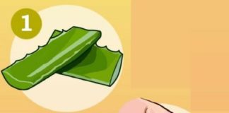 Healthcare infographic : Healthcare infographic : Prevent Chafing Skin By Trying One Of These 7 Home Remedies!!!