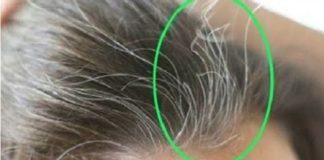 Medical infographic : Ceci est une vraie magie: Avec ce mélange vos cheveux gris deviendront du passé!!!