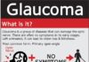 Medical infographic : Medical infographic : Een infographic over glaucoom in de USA. #Glaucoma #Infographic