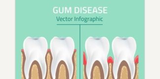 Medical infographic : Medical infographic : Medical infographic : Gum Disease Stages. Medical Infographic. $3.00