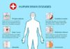 Medical infographic : Medical infographic : Medical infographic : Mental Health and brain diseases. Medical Infographic. $4….