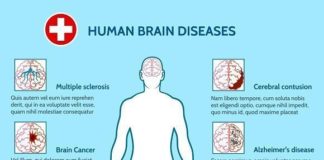 Medical infographic : Medical infographic : Medical infographic : Mental Health and brain diseases. Medical Infographic. $4….