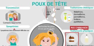 Medical infographic : Mieux comprendre les poux, notre nouvelle infographie (2018) sur les poux. L’inf…