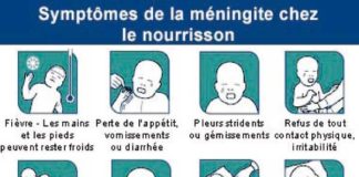 Medical infographic : Symptômes de la méningite chez le nourrisson