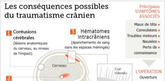 Medical infographic : Traumatisme crânien : des degrés de gravité variables