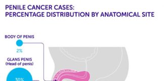 Statistics infographic : Infographics Photoshop #InfographicsStatistics