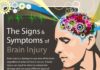 Statistics infographic : Statistics infographic : Statistics infographic Signs & Symptoms of Brain Injury Infographic by www.allenandallen… Infographic Description Signs & Symptoms of Brain Injury Infographic by www.allenandallen… – Infographic Source