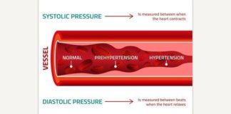 Medical infographic : Medical infographic : Blood Pressure Infographic. Medical Infographic. $3.00