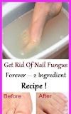 Healthcare infographic : Nail Fungus Can Be Dangerous Remove This By Using Recipe Of 2 Ingredients