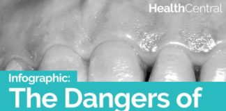 Health infographic : The Dangers of Unhealthy Teeth (INFOGRAPHIC)
