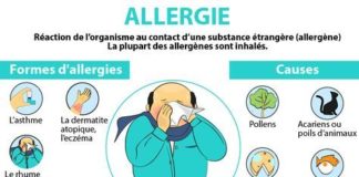 Educational infographic : #allergie – Tout savoir sur les allergies