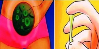 Fashion infographic : 8 SIGNS OF AN UNHEALTHY VAGINA & 10 THINGS YOU CAN DO ABOUT IT