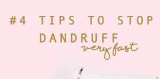 Fashion infographic : How to Get Rid of Dandruff Fast