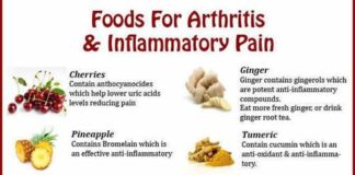 Food infographic – Arthritis stems from inflammation. Foods that fight inflammation can help reduc…