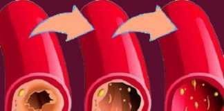 Health infographic : 12 Foods That Unclog Arteries Naturally and Protect Against Heart Attack