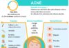 Health infographic : Acné : causes, symptômes & traitements | Creapharma