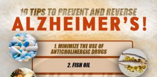 Health infographic : Dementia is a term that has been used in describing similar brain damaging condi…