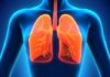 Health infographic : How to Clean Your Lungs Naturally