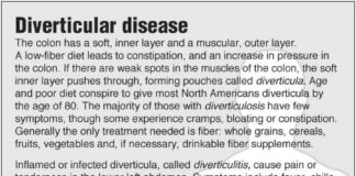 Health infographic : Information graphic about diverticulosis and diverticulitis with links to… …