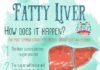 Health infographic : Recomended food for fatty liver, an infographic about fatty liver. We are want t…
