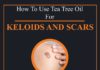 Health infographic : Tea Tree Oil for Keloids and Scars: 10 Natural Remedies