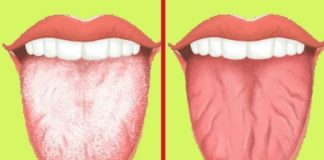Health infographic : What Your Tongue Can Tell You About Your Health
