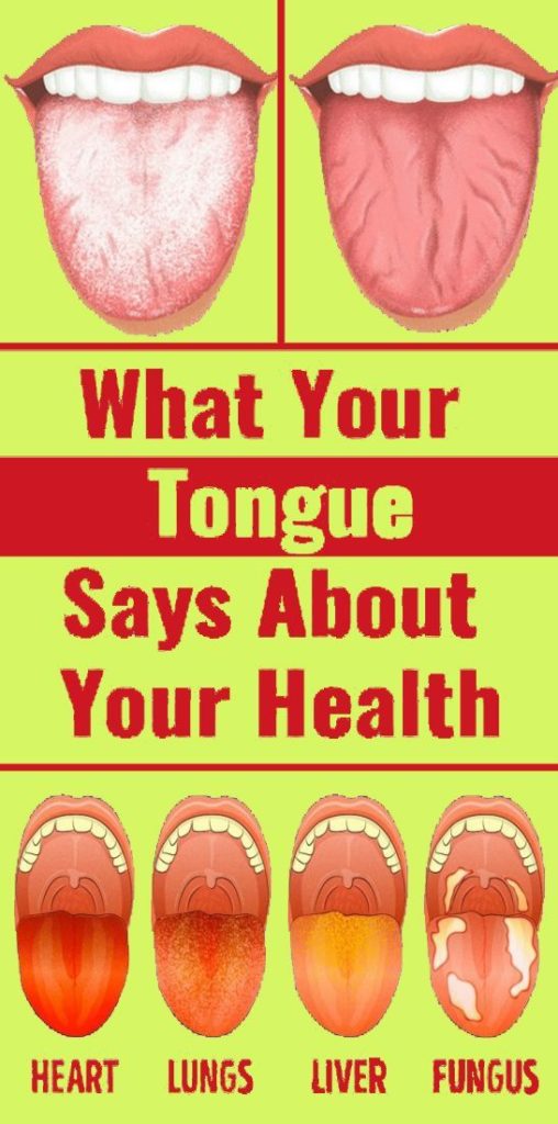 Health Infographic What Your Tongue Can Tell You About Your Health Your 9586