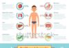 Healthcare infographic : Healthcare infographic elements with human different organs set. Medicine vector…