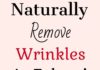 Healthcare infographic : How To Remove Wrinkles From Your Skin Naturally! – Mom Cares