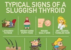 Healthcare infographic : Hypothyroidism is one of the most common, preventable disorders associated with …
