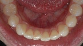 Healthcare infographic : Magical Whiten Teeth Treatment Naturally At Home