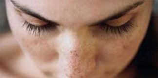 Healthcare infographic : The Essential Guide To Remove Dark Circles From Skin Using Common Baby Oil