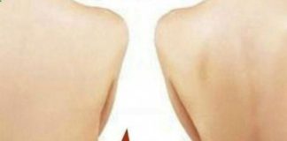 Healthcare infographic : What Can Cause Weight Gain And Hair Loss #HealthcareInfographics