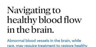 Medical infographic : Abnormal blood vessels in the brain, while rare, may require treatment to restor…