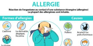 Medical infographic : Allergie : causes, symptômes & traitements | Creapharma