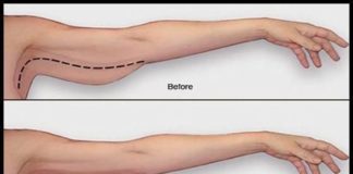 Medical infographic : Best Weight Loss Tricks Tips #HealthcareInfographics