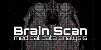 Medical infographic : Brain scan abstract backgrounds. Illustrations