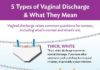 Medical infographic : Every woman suffers from #vaginal #discharge. 👩 Here are 5 Types of Vaginal D…