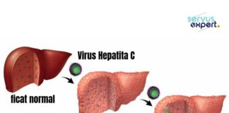 Medical infographic : HEPATITA C este o boală tratabilă. Află cum obții GRATUIT tratamentul