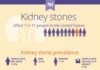 Medical infographic : Kidney Stones 101 (Infographic) | Northwestern Medicine