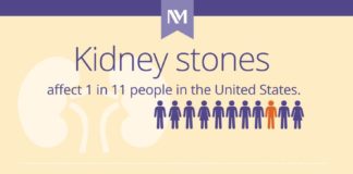 Medical infographic : Kidney Stones 101 (Infographic) | Northwestern Medicine