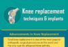 Medical infographic : Knee Replacement Techniques and Implants #infographic #Health #Knee