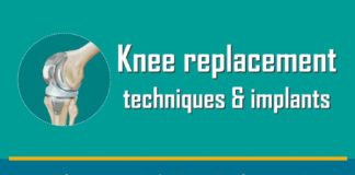 Medical infographic : Knee Replacement Techniques and Implants #infographic #Health #Knee
