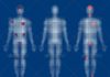 Medical infographic : Medical Info-Graphics #GraphicRiver Vector Human Body With Areas Of Pai…