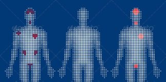 Medical infographic : Medical Info-Graphics #GraphicRiver Vector Human Body With Areas Of Pai…